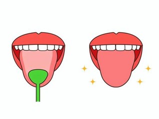 歯だけじゃない！健康な毎日を送るための舌ケアの重要性とは？